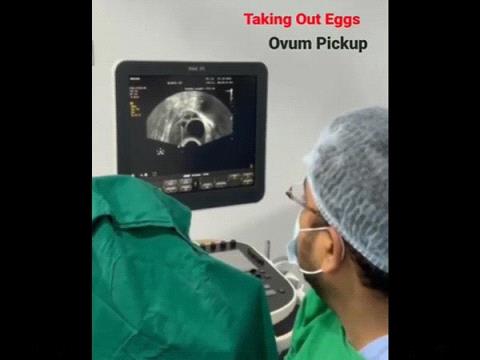 OVUM PICKUP SUSHIL IVF CENTRE, SANG